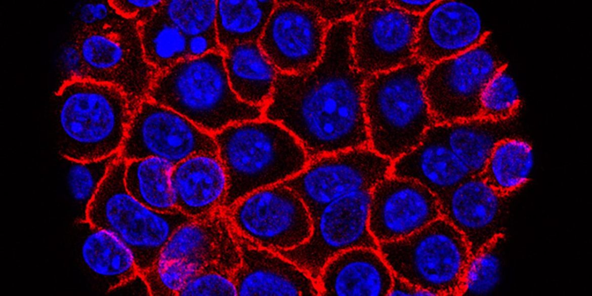 Experimental pill nearly doubles survival time for people with advanced pancreatic cancer. ‘I actually started crying’